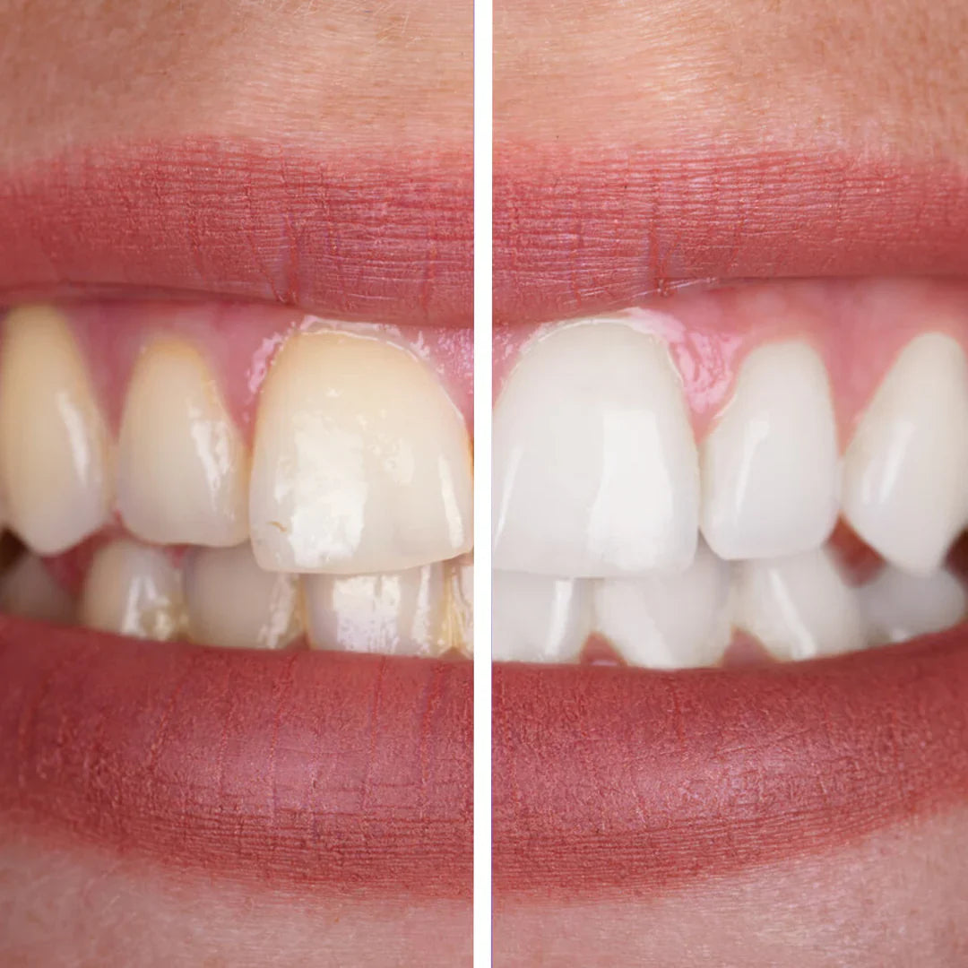Purple Toothpaste